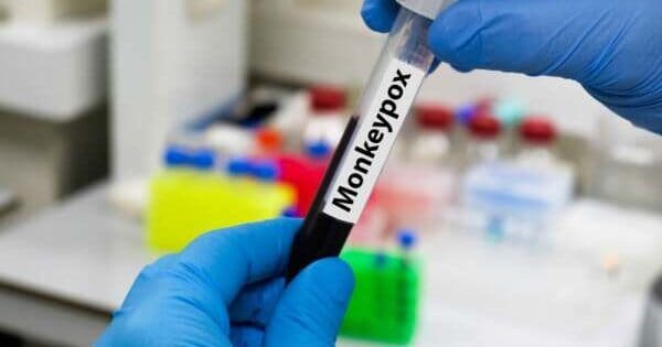 12966A0E9D6C738A82Dddcbdb7Bdb267 1