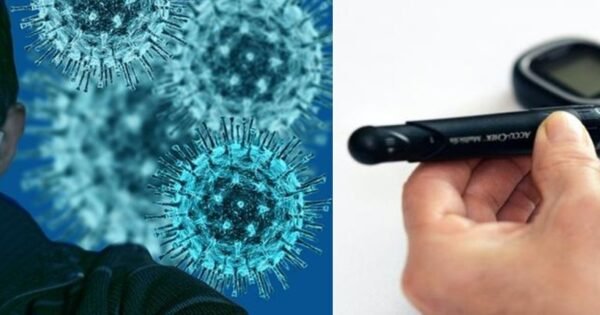 55Effe571247Fd75Bd6Bf18E0985046B