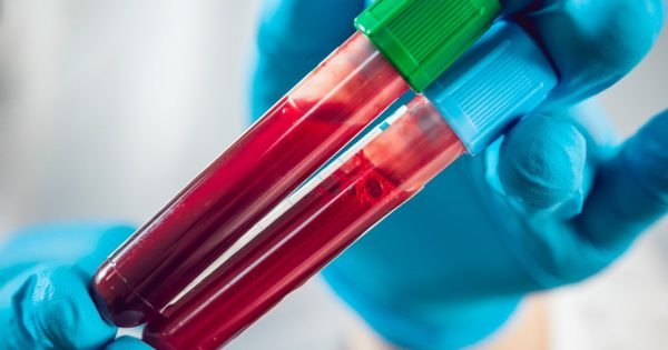 10Aa4E382A12223580E0C705638Af956