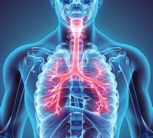 Shockingly Alarming: Bronchitis And Pneumonia By Age 2 Can Double Early Death Risk As Adults