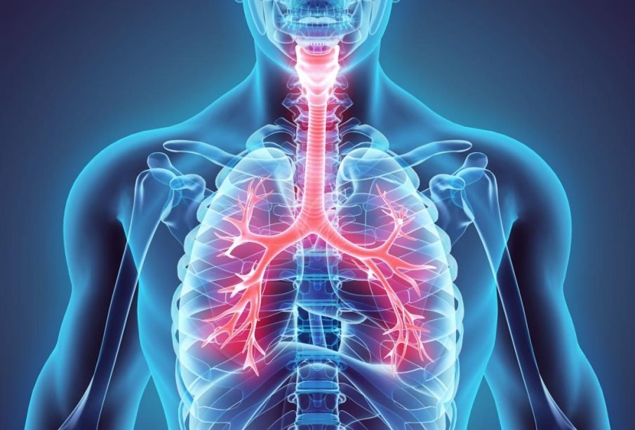 Shockingly Alarming: Bronchitis And Pneumonia By Age 2 Can Double Early Death Risk As Adults