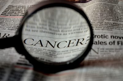 Delaying Harsh Treatments For Prostate Cancer May Not Up Death Risk: Study
