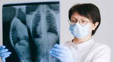 When Rheumatoid Arthritis Affects Your Lungs