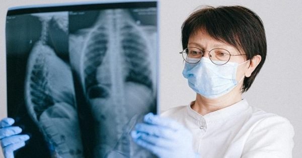 When Rheumatoid Arthritis Affects Your Lungs