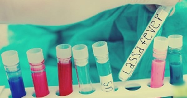 Update: Death Toll Rises To 104 In Nigeria'S Lassa Fever Outbreak